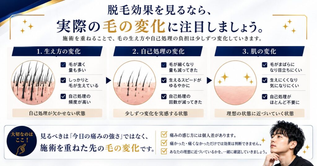 メンズ脱毛の施術を重ねることで毛の生え方や自己処理の頻度が変化していく様子を示した図